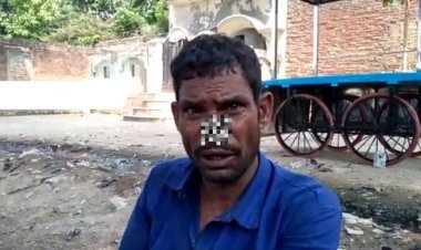 Hardoi: क्यों जीजा ने काटी साले की नाक?, जानिए क्या हैं पूरा मामला
