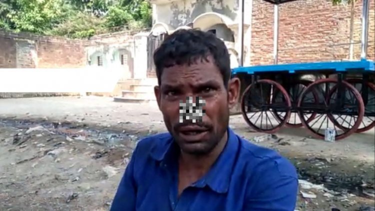Hardoi: क्यों जीजा ने काटी साले की नाक?, जानिए क्या हैं पूरा मामला