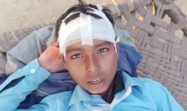 Fatehpur: छात्र को पीट-पीटकर टीचर ने किया लहुलुहान, सिर पर आए कई टांके